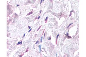 Anti-CXCL12 antibody IHC of human breast, fibroblasts.