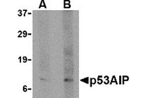 Western Blotting (WB) image for anti-P53-Regulated Apoptosis-Inducing Protein 1 (TP53AIP1) (N-Term) antibody (ABIN1031499)