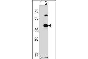 Western blot analysis of STR (arrow) using rabbit polyclonal STR Antibody (C-term) 2933b.