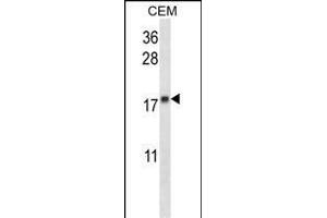 MGMT Antibody (N-term) (ABIN657769 and ABIN2846745) western blot analysis in CEM cell line lysates (35 μg/lane). (MGMT antibody  (N-Term))