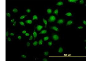 Image no. 3 for anti-Transcription Factor AP-4 (Activating Enhancer Binding Protein 4) (TFAP4) (AA 93-193) antibody (ABIN598970) (TFAP4 antibody  (AA 93-193))