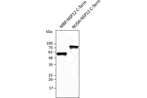 SARS-CoV-2 NSP12 (RdRP) antibody  (C-Term)