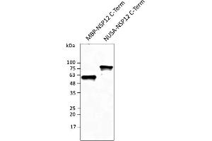 Western Blotting (WB) image for anti-SARS-CoV-2 RNA-dependent RNA Polymerase (NSP12) (SARS-CoV-2 RdRP) (C-Term) antibody (ABIN7273004) (SARS-CoV-2 NSP12 (RdRP) antibody  (C-Term))