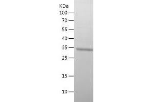 TMPRSS4 Protein (AA 311-437) (His-IF2DI Tag)