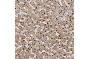 Immunohistochemical staining of human liver with AOF1 polyclonal antibody  shows nuclear and cytoplasmic positivity in hepatocytes.