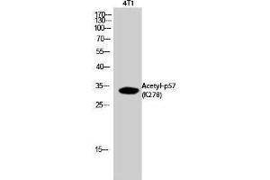 Western Blotting (WB) image for anti-P57 (acLys278) antibody (ABIN3181900) (P57 (acLys278) antibody)
