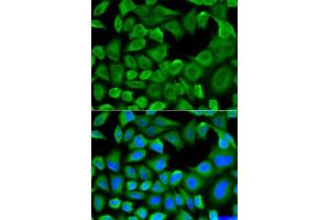 Immunofluorescence analysis of HeLa cells using BCL2L11 antibody. (BIM antibody)