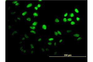 Immunofluorescence of monoclonal antibody to FOXF2 on HeLa cell. (FOXF2 antibody  (AA 346-443))