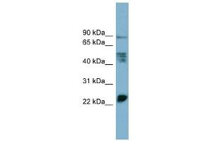 WB Suggested Anti-MPZL1 Antibody Titration:  0. (MPZL1 antibody  (Middle Region))