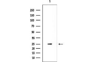 Western blot analysis of lysates from K562 cells, using PTPMT1 Mouse Monoclonal Antibody at 1/1000 dilution.