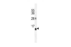 AVPI1 Antibody (N-term) (ABIN654463 and ABIN2844196) western blot analysis in MCF-7 cell line lysates (35 μg/lane). (AVPI1 antibody  (N-Term))