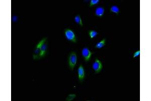 Immunofluorescence staining of A549 cells with ABIN7154684 at 1:200, counter-stained with DAPI. (GNGT2 antibody  (AA 1-66))