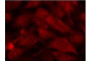 Image no. 2 for anti-Stathmin 1 (STMN1) (Ser37) antibody (ABIN197457) (Stathmin 1 antibody  (Ser37))