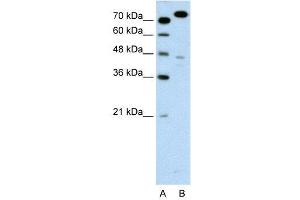 WB Suggested Anti-MCM3  Antibody Titration: 0. (MCM3 antibody  (C-Term))