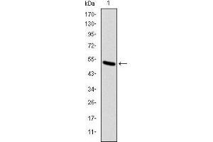 Western blot analysis using KID mAb against human KID (AA: 225-419) recombinant protein. (KIF22 antibody)