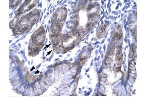 Human Stomach; Rabbit Anti-EAP30 Antibody. (SNF8 antibody  (N-Term))