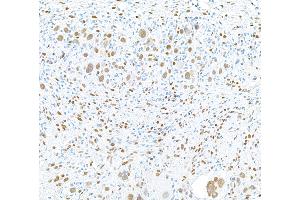 Immunohistochemistry (IHC) image for anti-RNA Binding Motif Protein 9 (RBM9) (AA 1-50) antibody (ABIN7454009) (Recombinant RBM9 antibody  (AA 1-50))