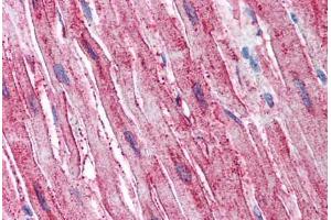 Immunohistochemistry (Paraffin-embedded Sections) (IHC (p)) image for anti-ADAM Metallopeptidase with Thrombospondin Type 1 Motif, 4 (ADAMTS4) (Internal Region) antibody (ABIN625840)