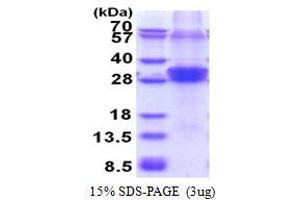 SDS-PAGE (SDS) image for Ring Finger Protein 114 (RNF114) (AA 1-228) protein (His tag) (ABIN5853600) (RNF114 Protein (AA 1-228) (His tag))