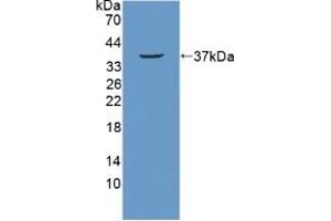Detection of Recombinant NUP214, Mouse using Polyclonal Antibody to Nucleoporin 214 kDa (NUP214)