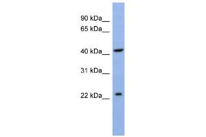 WB Suggested Anti-SLC35F1 Antibody Titration:  0.