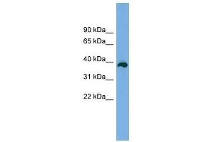Western Blot showing DEDD2 antibody used at a concentration of 1-2 ug/ml to detect its target protein. (DEDD2 antibody  (Middle Region))