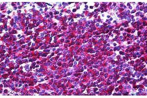 Human Spleen: Formalin-Fixed, Paraffin-Embedded (FFPE) (IL16 antibody)