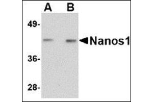 Western blot analysis of Nanos1 in rat brain tissue lysate with this product at (A) 1 and (B) 2 μg/ml.