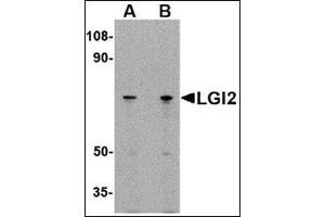 Western blot analysis of LGI2 in 293 cell lysate with this product at (A) 1 and (B) 2 μg/ml.