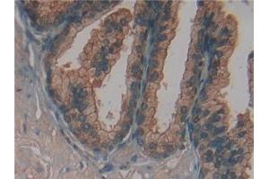Detection of FUCa1 in Human Prostate Tissue using Polyclonal Antibody to Fucosidase Alpha L1, Tissue (FUCa1) (FUCA1 antibody  (AA 53-289))