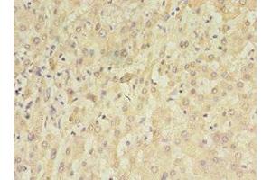 Immunohistochemistry of paraffin-embedded human liver tissue using ABIN7159638 at dilution of 1:100 (TET3 antibody  (AA 72-335))
