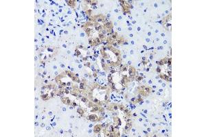 Immunohistochemistry of paraffin-embedded rat kidney using Calbindin antibody (ABIN7266004) at dilution of 1:100 (40x lens). (CALB1 antibody  (AA 1-261))