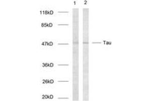 Western blot analysis of extracts from HeLa cells, using Tau (Ab-214) Antibody. (tau antibody  (AA 501-550))