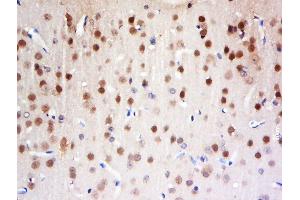 Paraformaldehyde-fixed, paraffin embedded rat brain tissue, Antigen retrieval by boiling in sodium citrate buffer(pH6) for 15min, Block endogenous peroxidase by 3% hydrogen peroxide for 30 minutes, Blocking buffer (normal goat serum) at 37°C for 20min, Antibody incubation with Rabbit Anti-FAM13C1 Polyclonal Antibody, Unconjugated  at 1:500 overnight at 4°C, followed by a conjugated secondary and DAB staining (FAM13C antibody  (AA 51-150))