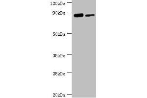 Western blot All lanes: TFIIH basal transcription factor complex helicase XPD subunit antibody at 2 μg/mL Lane 1: 293T whole cell lysate Lane 2: K562 whole cell lysate Secondary Goat polyclonal to rabbit IgG at 1/10000 dilution Predicted band size: 87, 47 kDa Observed band size: 87 kDa