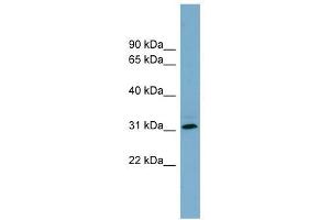 RNF144B antibody used at 1 ug/ml to detect target protein. (RNF144B antibody  (Middle Region))