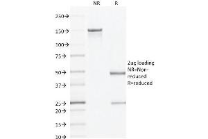 SDS-PAGE (SDS) image for anti-alpha-Methylacyl-CoA Racemase (AMACR) (AA 297-394) antibody (ABIN6939431)
