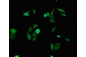 Immunofluorescent analysis of Hela cells using ABIN7168925 at dilution of 1:100 and Alexa Fluor 488-congugated AffiniPure Goat Anti-Rabbit IgG(H+L) (SPINK1 antibody  (AA 19-79))