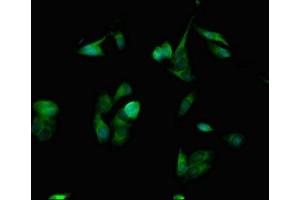 SPINK1 antibody  (AA 19-79)