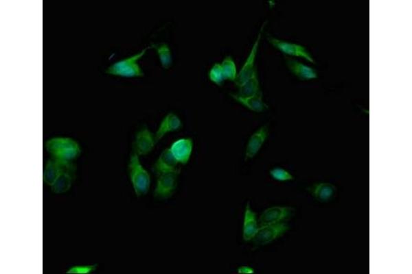 SPINK1 antibody  (AA 19-79)