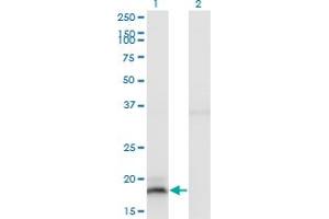 Western Blot analysis of IFNA13 expression in transfected 293T cell line by IFNA13 monoclonal antibody (M03), clone 3F9. (IFNA13 antibody  (AA 91-189))