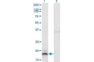 IFNA13 antibody  (AA 91-189)