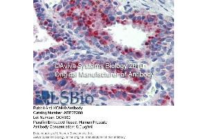 Immunohistochemistry (IHC) image for anti-Potassium Channel, Subfamily K, Member 9 (KCNK9) (N-Term) antibody (ABIN2776216) (KCNK9 antibody  (N-Term))