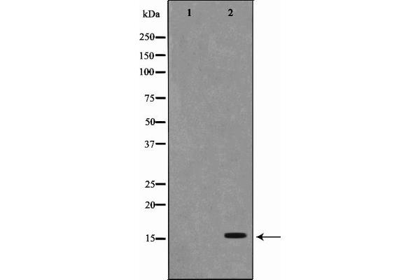 PFDN1 antibody  (Internal Region)