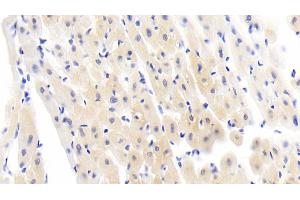 Detection of IL6 in Human Cardiac Muscle Tissue using Polyclonal Antibody to Interleukin 6 (IL6) (IL-6 antibody  (AA 27-212))