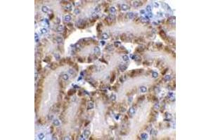 Immunohistochemistry of CAD in mouse kidney tissue with CAD antibody at 2 μg/ml. (DFFB antibody)
