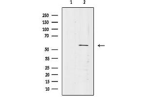 anti-Vascular Endothelial Zinc Finger 1 (VEZF1) (Internal Region) antibody