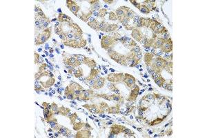 Immunohistochemistry of paraffin-embedded human stomach using ETFA antibody. (ETFA antibody  (AA 1-333))