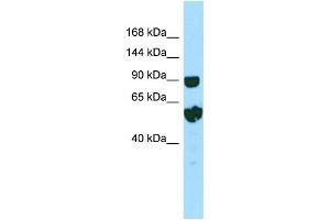 WB Suggested Anti-RPTN Antibody Titration: 1.