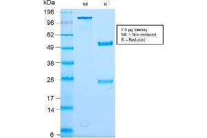SDS-PAGE Analysis Purified Neurofilament Rabbit Monoclonal Antibody (NEFL/2983R). (Recombinant NEFL antibody)